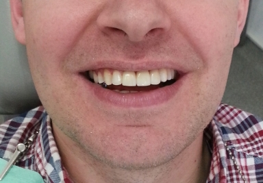 Orthodontic treatment