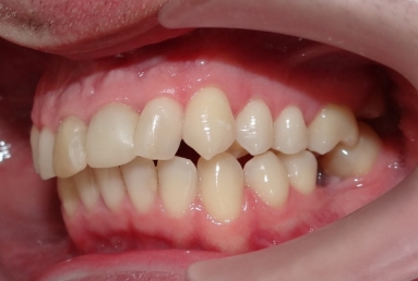 tratament ortodontic