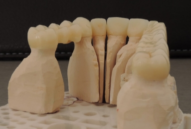 implanturi si punte ceramica