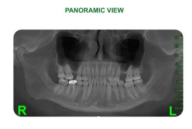 Orthodontic treatment